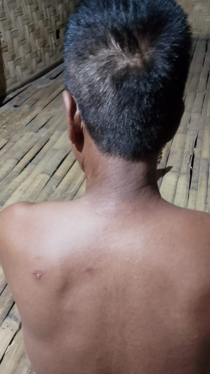 Oknum Dokter Puskesmas Mamboro Diduga Terlibat Rekayasa Visum, Polres Sumba Barat Diminta Bertindak