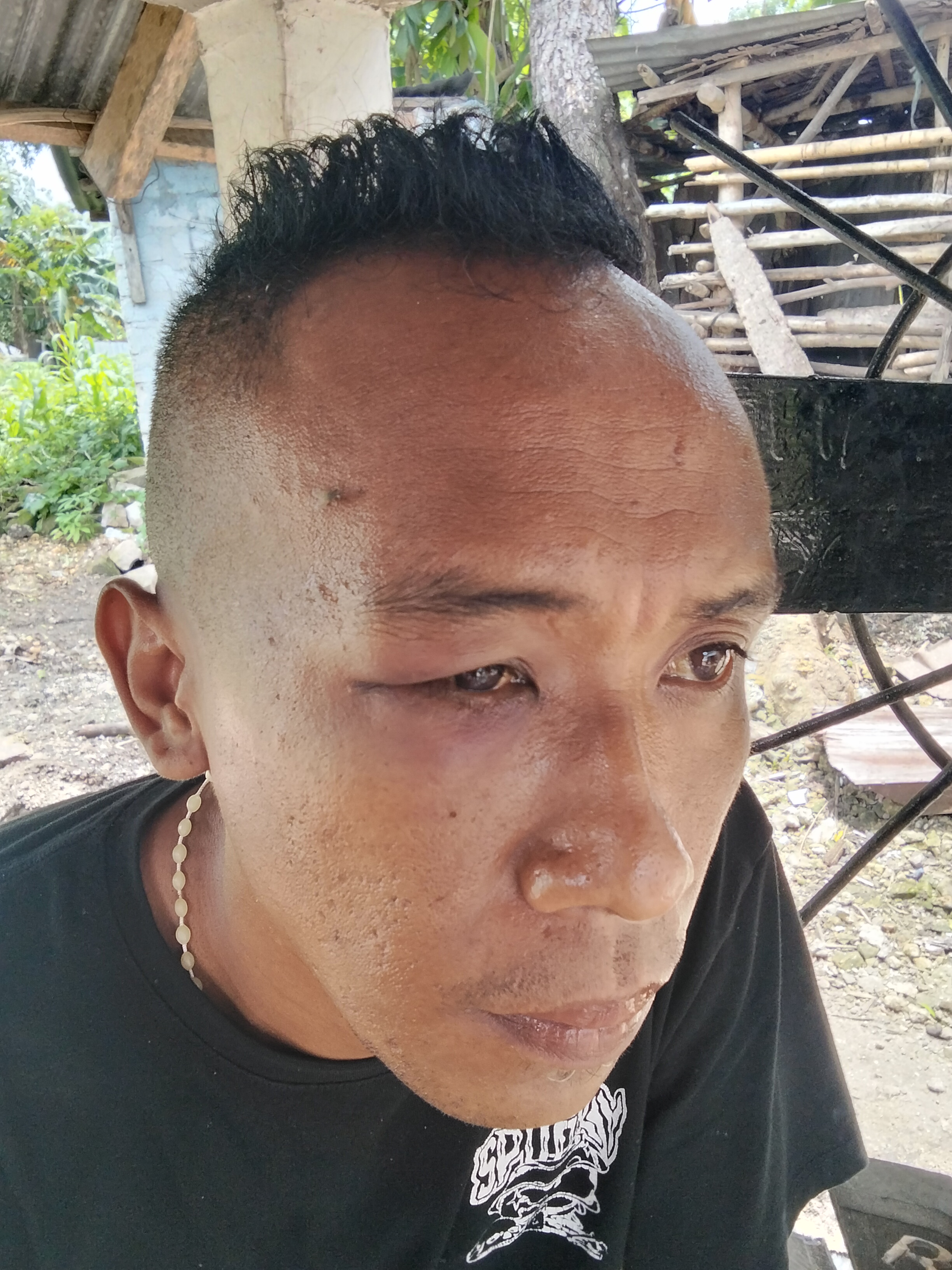 Pengeroyokan dan Penganiayaan di Depan Hotel Sumba Sejahtera, Keluarga Korban Minta Penegak Hukum Bertindak Tegas