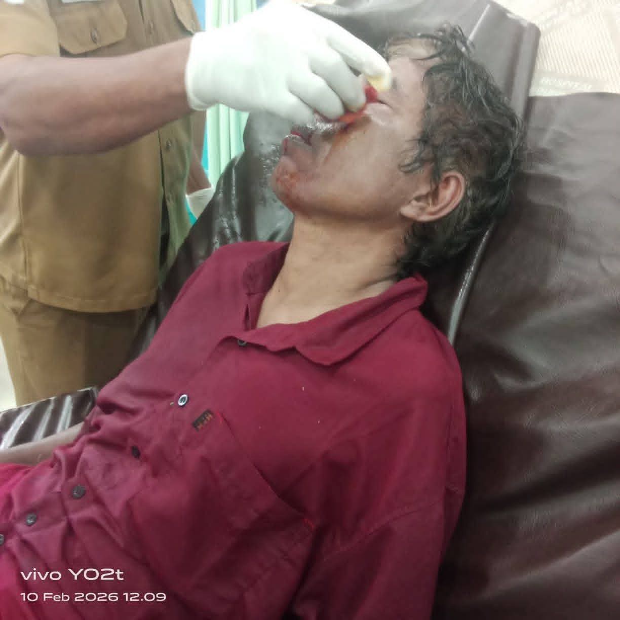 BATU MELAYANG, ADAT TERLUKA Rato Sodana Jadi Korban Pasola Lamboya, Terbaring di RSUD Waikabubak