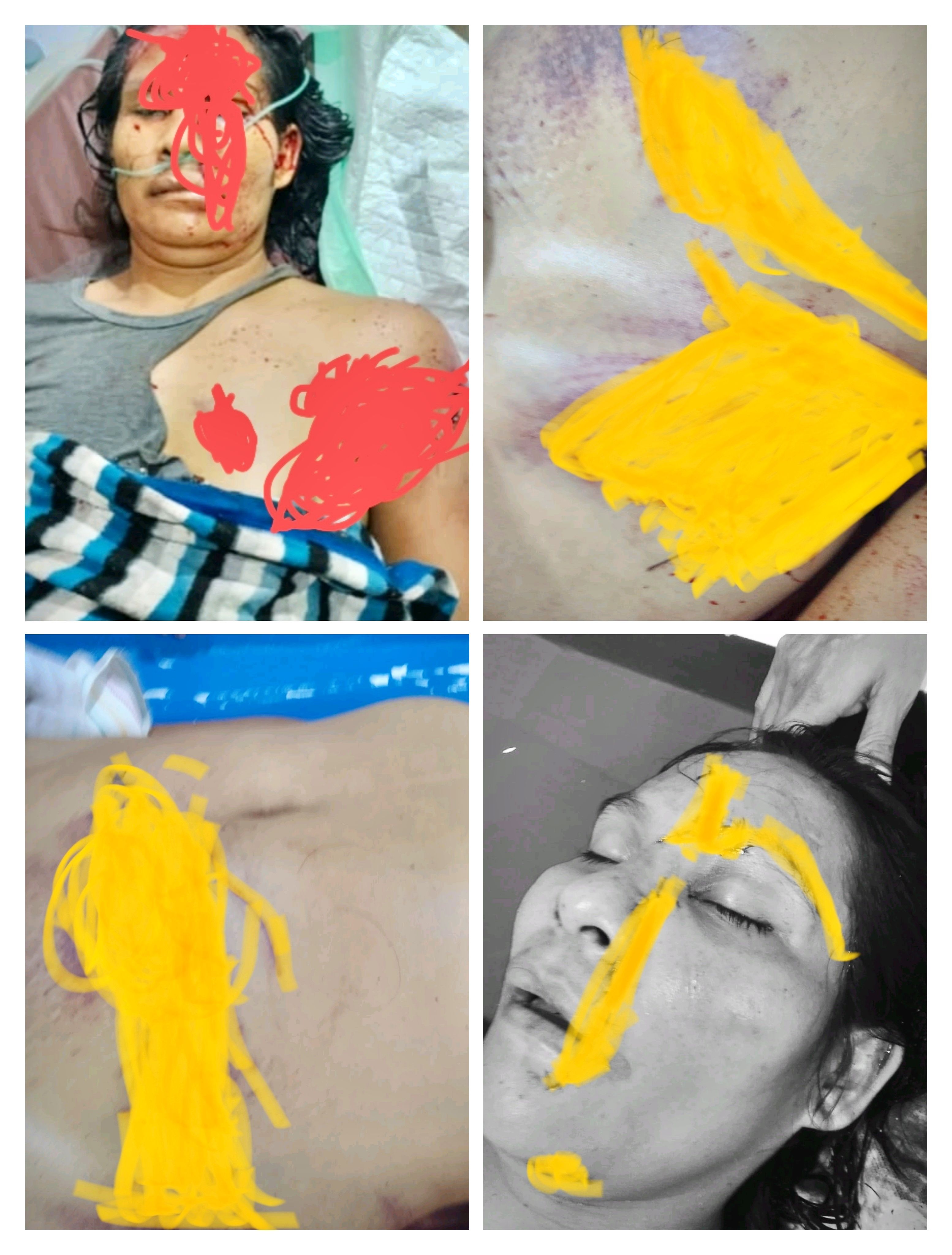 Dari “Laka Lantas” ke Dugaan Penganiayaan: Polisi Mulai Panggil Saksi Kasus Kematian Mama Alvin