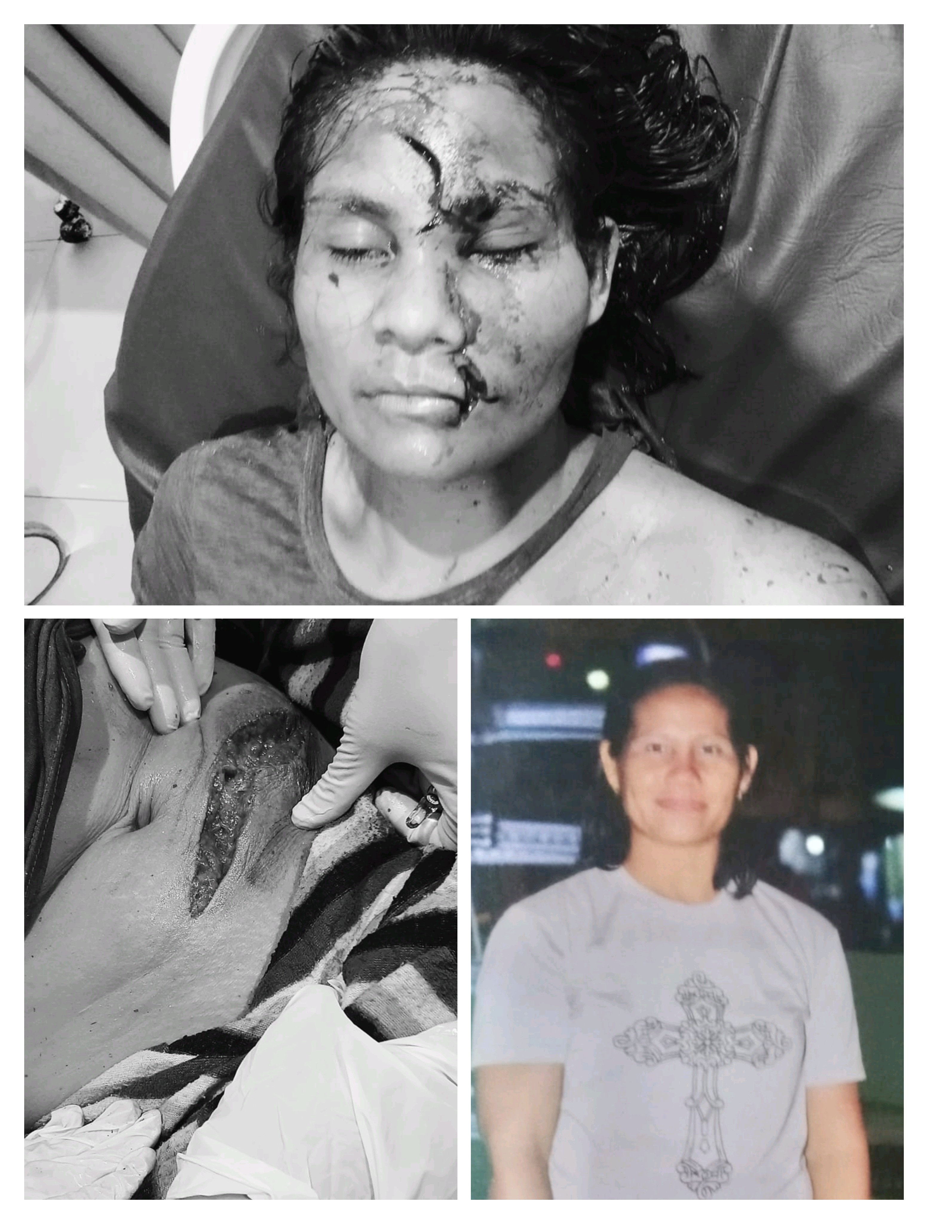 “21 Januari 2026: Jeritan yang Tak Sempat Terdengar, Misteri Luka Mama Alvin Mengguncang Wewewa Timur”