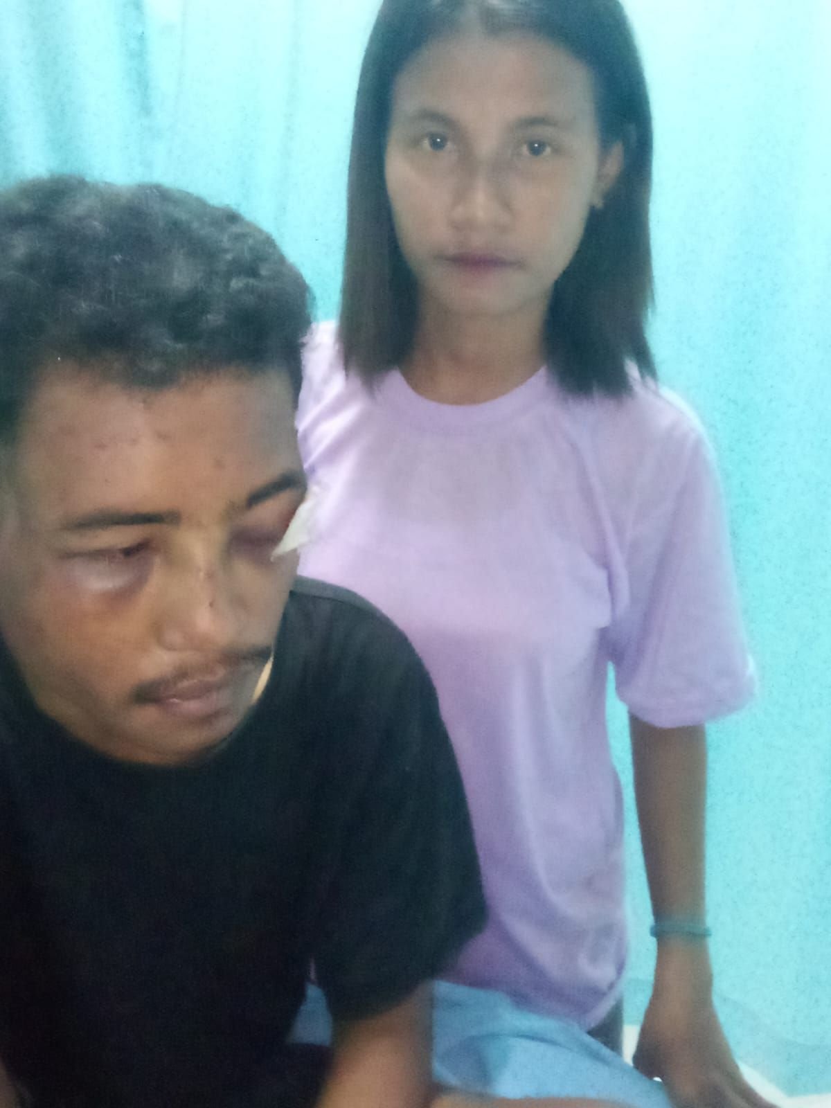 MOHON ATENSI KAPOLRES SUMBA TIMUR: PASIEN CUCI DARAH DIDUGA DIKEROYOK, DUA TERDUGA PELAKU DISEBUT TELAH DILEPAS