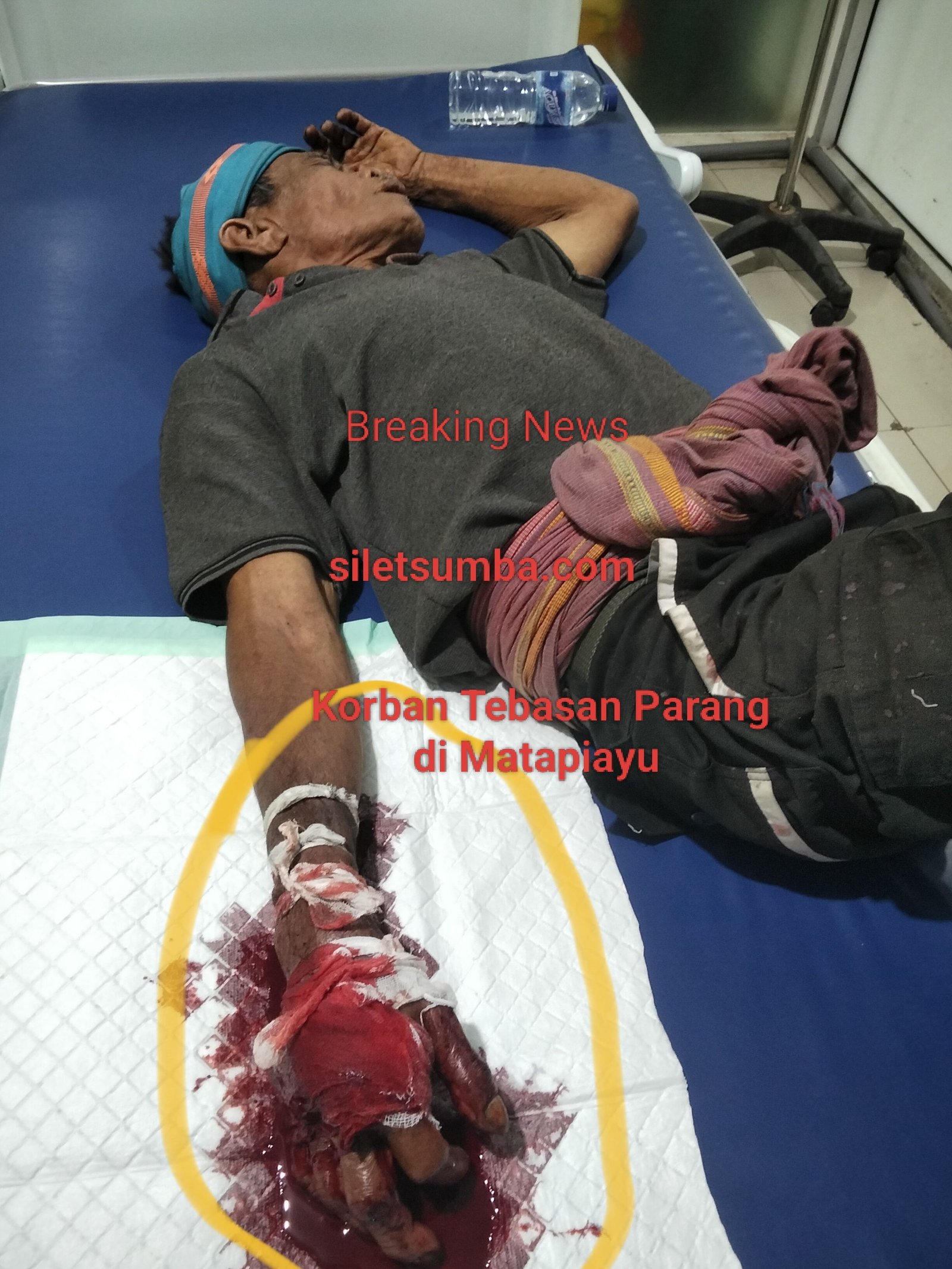 BREAKING NEWS: Warga  Mata Ptawu Diduga Jadi Korban Tebasan Parang, Tangan Kanan Terluka