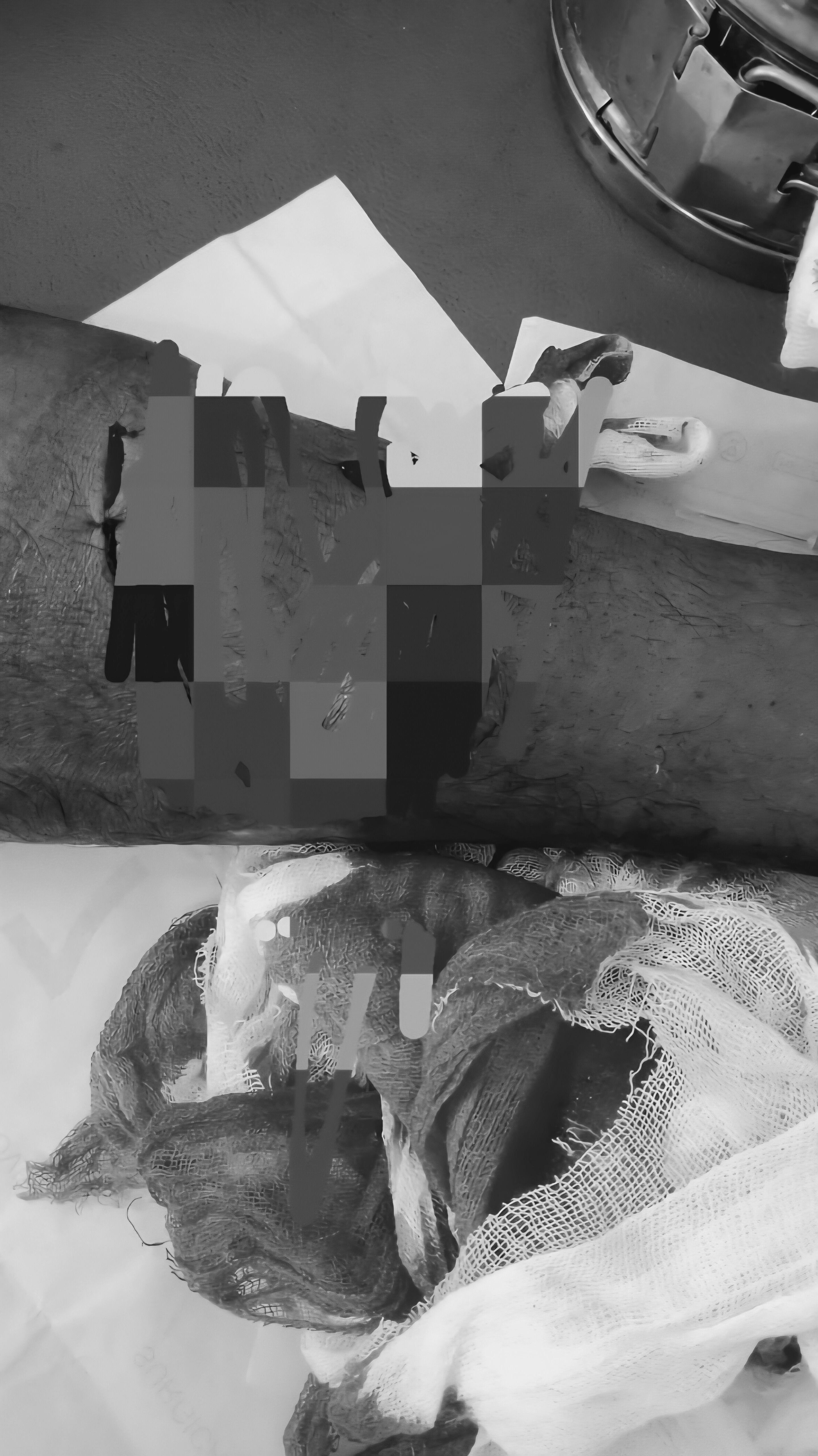 Misteri Luka ‘Bambu’ di Hari Nahas: Markus Kazat Terlihat di Lokasi Insiden Wee Kurra